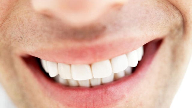 From Yellow to Wow: The Ultimate Guide to Teeth Whitening