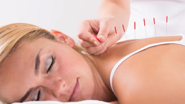 Needle Bliss: Unraveling the Mysteries of Acupuncture