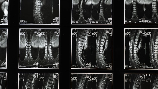 Understanding Pain Management